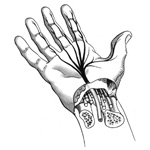 Carpal Tunnel Medical Illustration